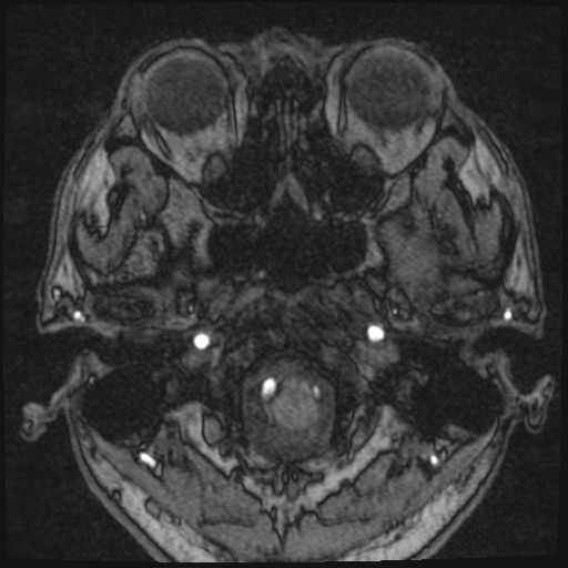 Click on the Serie image to view the images of VILLANUEVA, WILLIAM A.